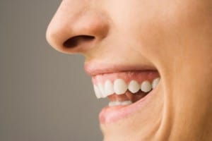 Overbite-treatment-with-Invisalign