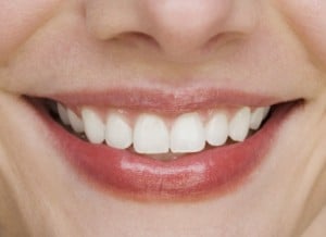 miami-dentist-invisalign-in-miami