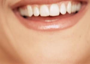miami-dentist-4-ways-prevent-gum-disease