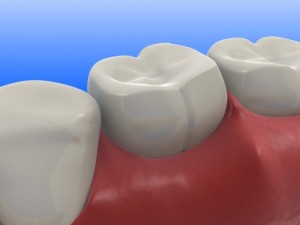 Japanese Researchers Invent ‘Tooth Patch’ to Prevent Tooth Decay