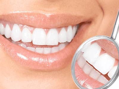 Save on Teeth Whitening and Invisalign® This December